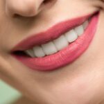Over The Counter Vs. Professional Teeth Whitening