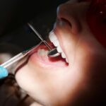 Chipped tooth repair in Vancouver, Washington