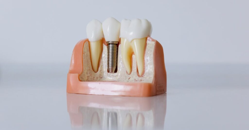 Detailed dental implant model showcasing teeth structure for educational purposes.